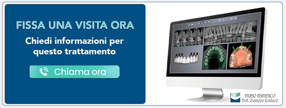 implantologia-computer-guidata Pescara