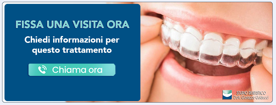 ortodonzia-con-mascherine-invisibili-invisalign Pescara